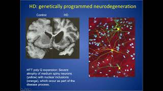 RESEARCH WEBINAR: Neural Stem Cells as a Therapeutic Candidate for Huntington's Disease