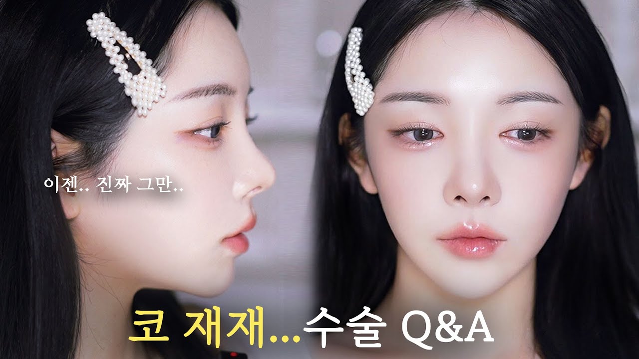 나의 진짜 마지막..코 재재수술...이걸 본 사람은 나처럼 하지마...ㅋ