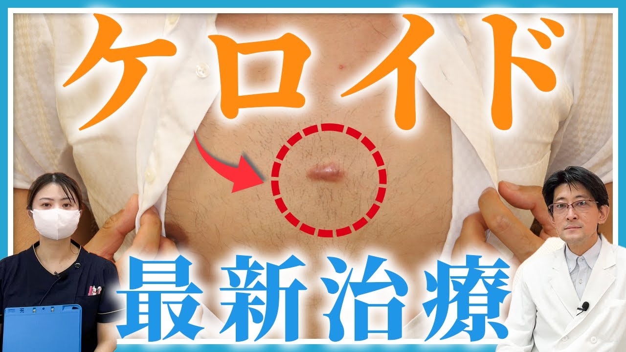 ケロイド治療の最新技術！レーザーとボトックスの驚きの効果