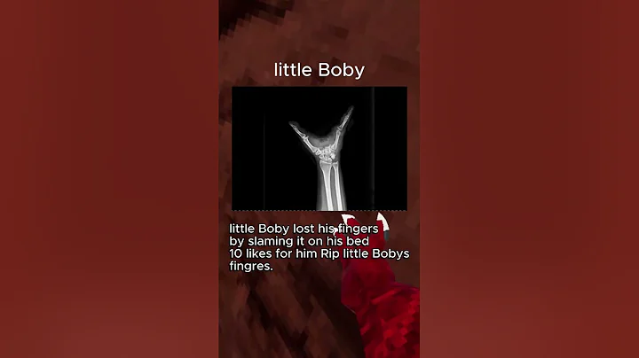 worst gtag injuries #gorillatag #injury #vr #gorillatag #gtag #vr