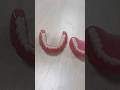 3D printed dentures #3dprinting #3dprinter #dentures #dental