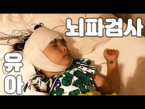 뇌신경 발달 뇌파검사 받던날 :: 루빈스타인 테이비 증후군 Rubinstein-Taybi syndrome