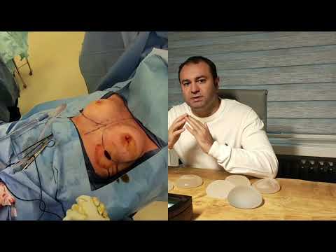 Video: Göğüs Implantları: Tehlikeli Veya Değil