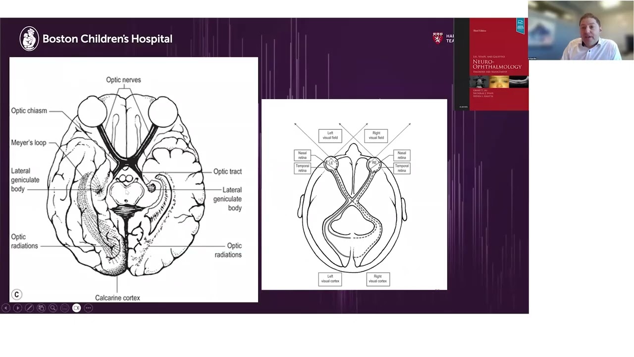 Lecture: The Role of OCT in Pediatric Neuro-Ophthalmology: Case-Based Insights & Applications