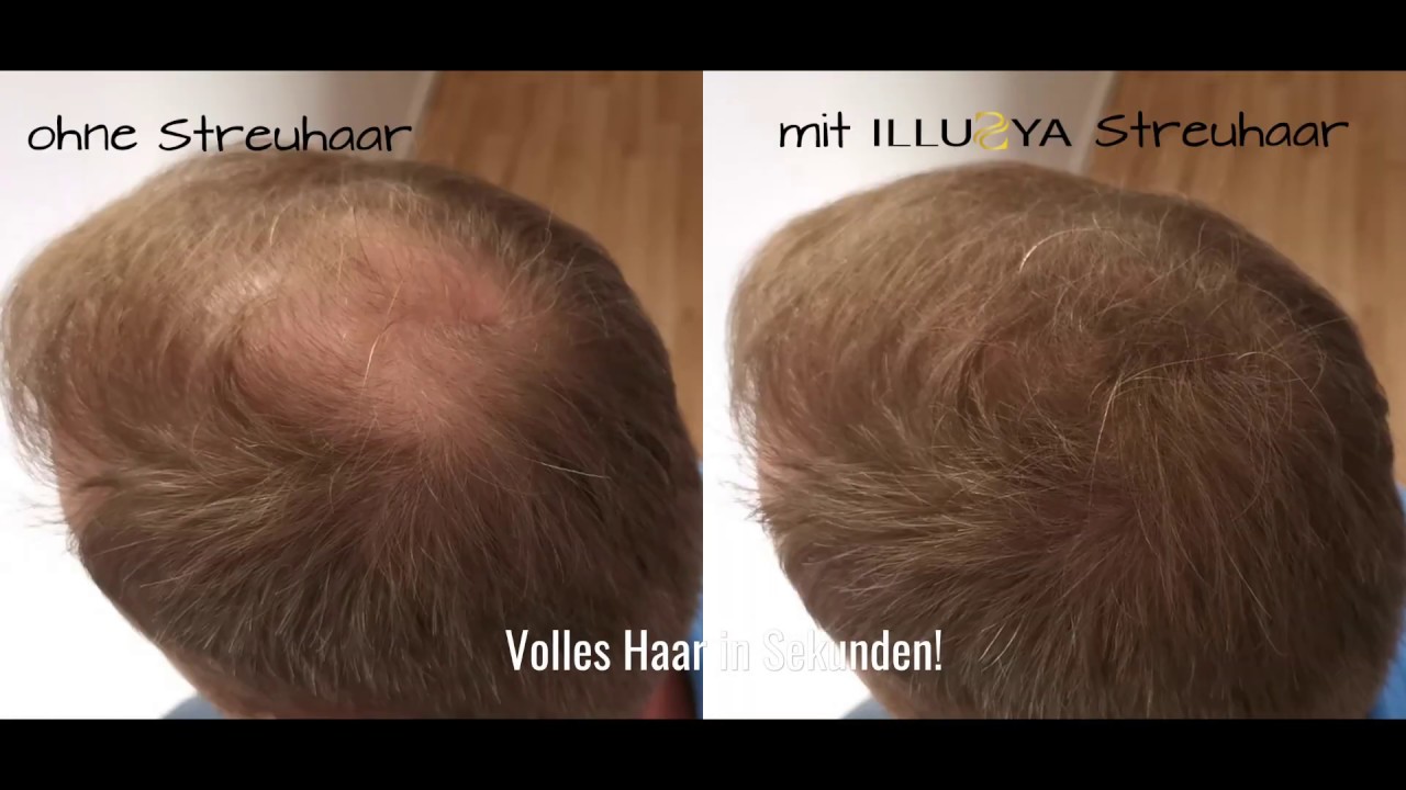 Illusya Hair Fibers Streuhaar Schutthaar Anwendung Der Streuhaare Volles Haar In Sekunden Youtube