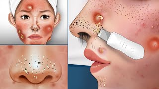 ASMR Causes and The best treatment for the girl who bought a fake face spa with a red face allergy