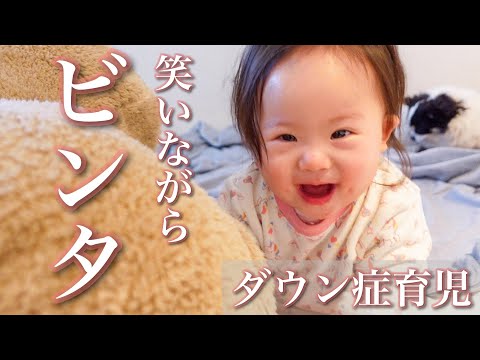 【予想外】ダウン症1歳児が習得したビンタに大喜びのママ【できれば助けて】