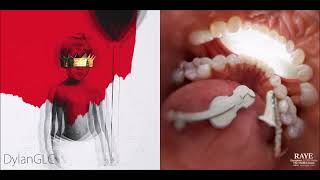 Escape It Better | RAYE feat. 070 Shake & Rihanna Mashup!