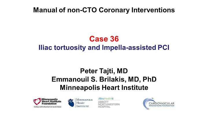 Case 36: PCI Manual - Challenges with Impella-assisted PCI