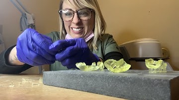 Dental 3d prints support removal - and 3d printing hazards