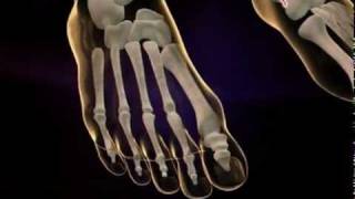 MyHEALTH : Gout