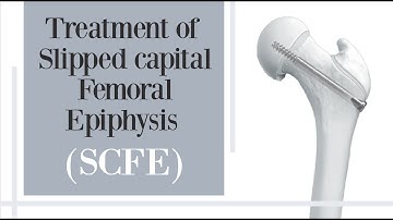 treatment of slipped capital femoral epiphysis SCFE - hip pain in children