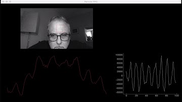Filtering a PPG in Realtime