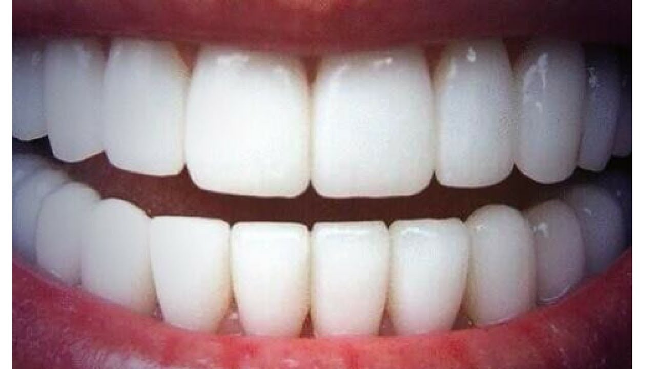 pate blanche sur les dents pate blanche sur les dents
