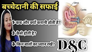 डी एंड सी क्या होती है || what is Dilation and Curettage when it Recommend (Hindi) || Hema mahara