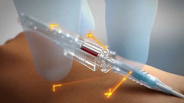 ClearSafe Comfort® Safety IV Catheters