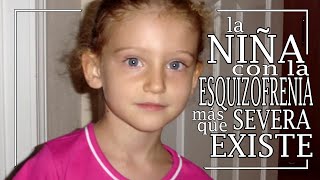 La Niña Con La Esquizofrenia Infantil Más Severa Que Existe