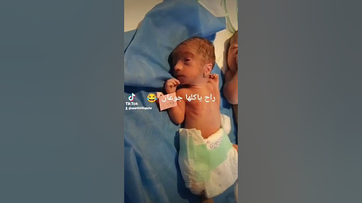 الفرق بين ولادة الطفل بتمام الاشهر وطفل ولاده مبكره