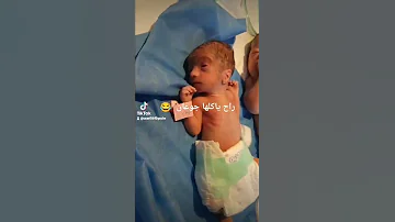 الفرق بين ولادة الطفل بتمام الاشهر وطفل ولاده مبكره 