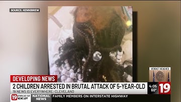 Prosecutors charge 2 children, 9 and 10, in brutal attack on 5-year-old Cleveland girl