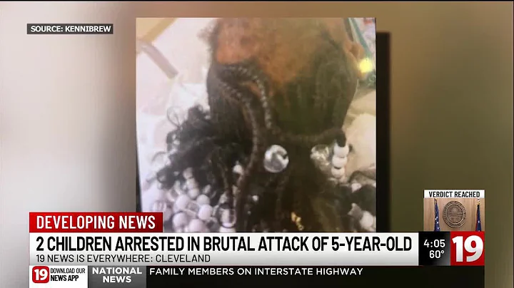 Prosecutors charge 2 children, 9 and 10, in brutal attack on 5-year-old Cleveland girl