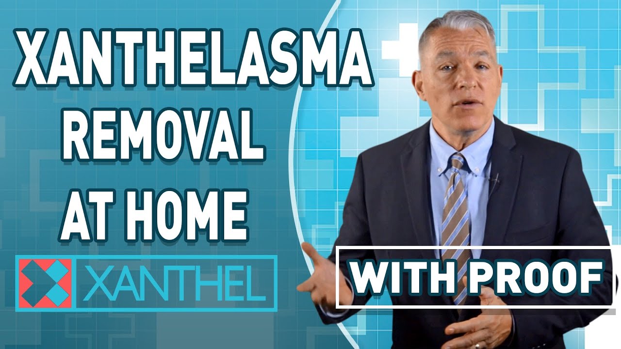 Xanthelasma Removal At Home - Made Easy With Xanthel