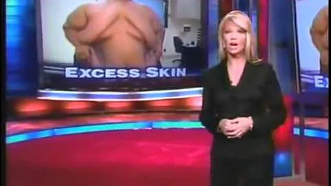 EXCESS SKIN - DayDayNews