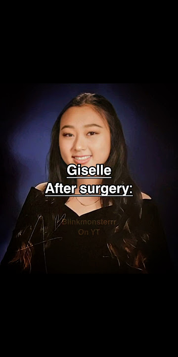 Plastic surgery is common in the kpop industry(NO HATE TO ME) #viral #trending #plasticsurgery