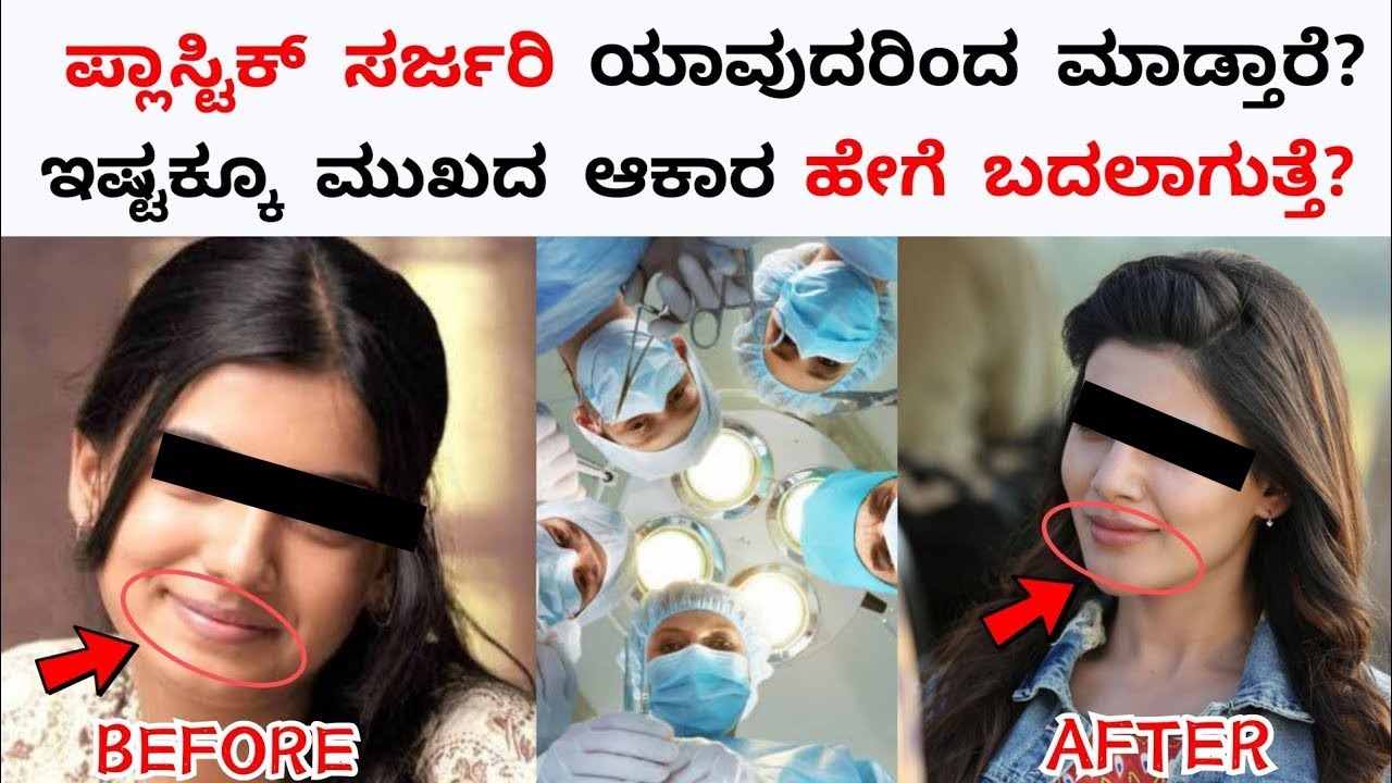 What is Plastic SurgeryTop 10 Interesting and Unknown Facts in Kannada