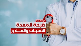 قرحة المعدة.. الأسباب والعلاج