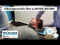 Advanced biostructural correction   chiropractic adjustment  fix neck hump  springbackchirocom