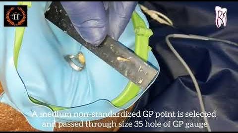 APICAL GAUGING AND CUSTOMIZING THE GUTTA PERCHA