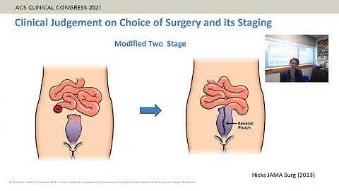Staged Approach for Ulcerative Colitis UC.  What, When and Why?