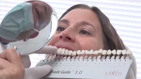 Chairside Shade Guide Overview