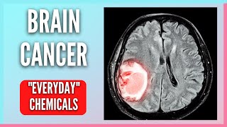 Common Everyday Chemicals Leading to Deadly Brain Cancer