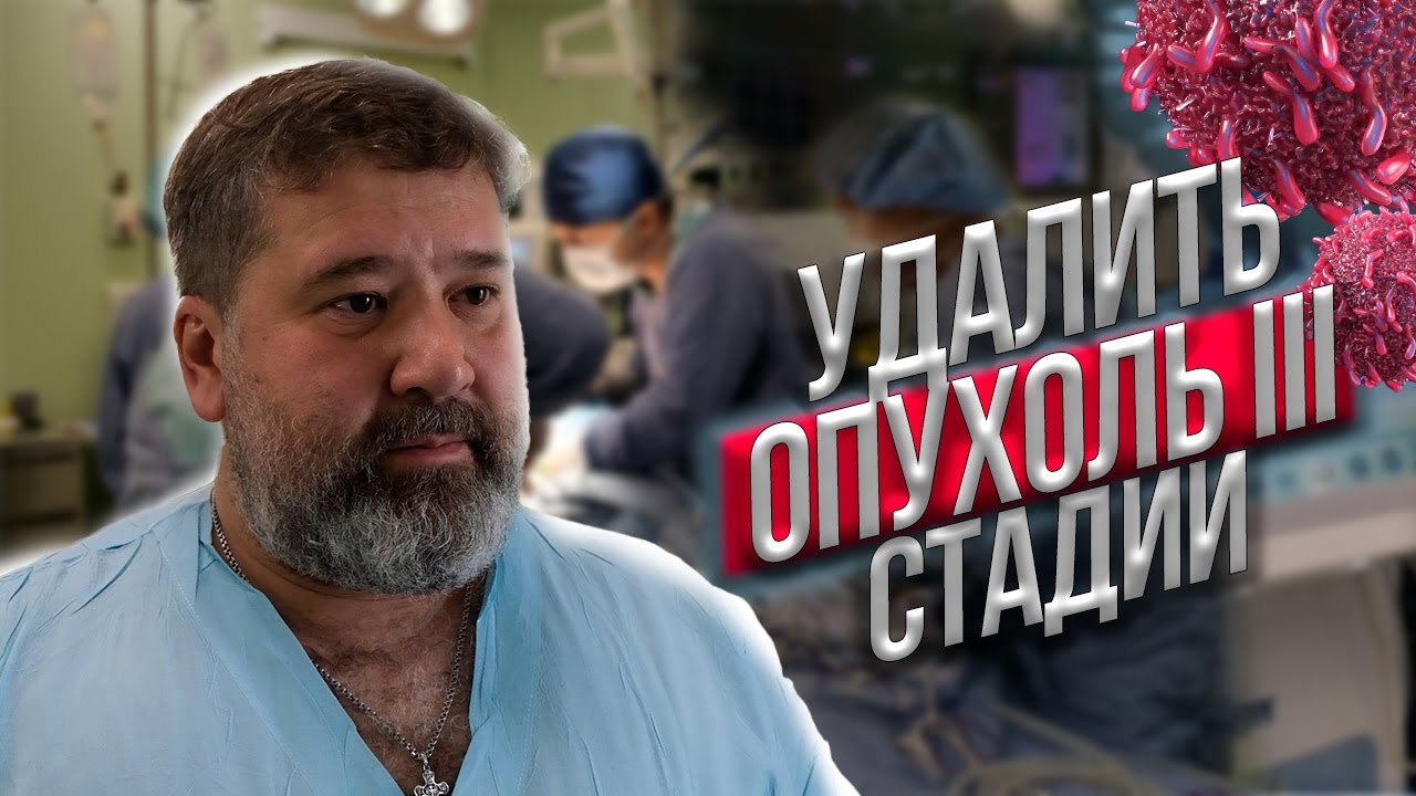 Удалить опухоль III стадии на почке... - YouTube