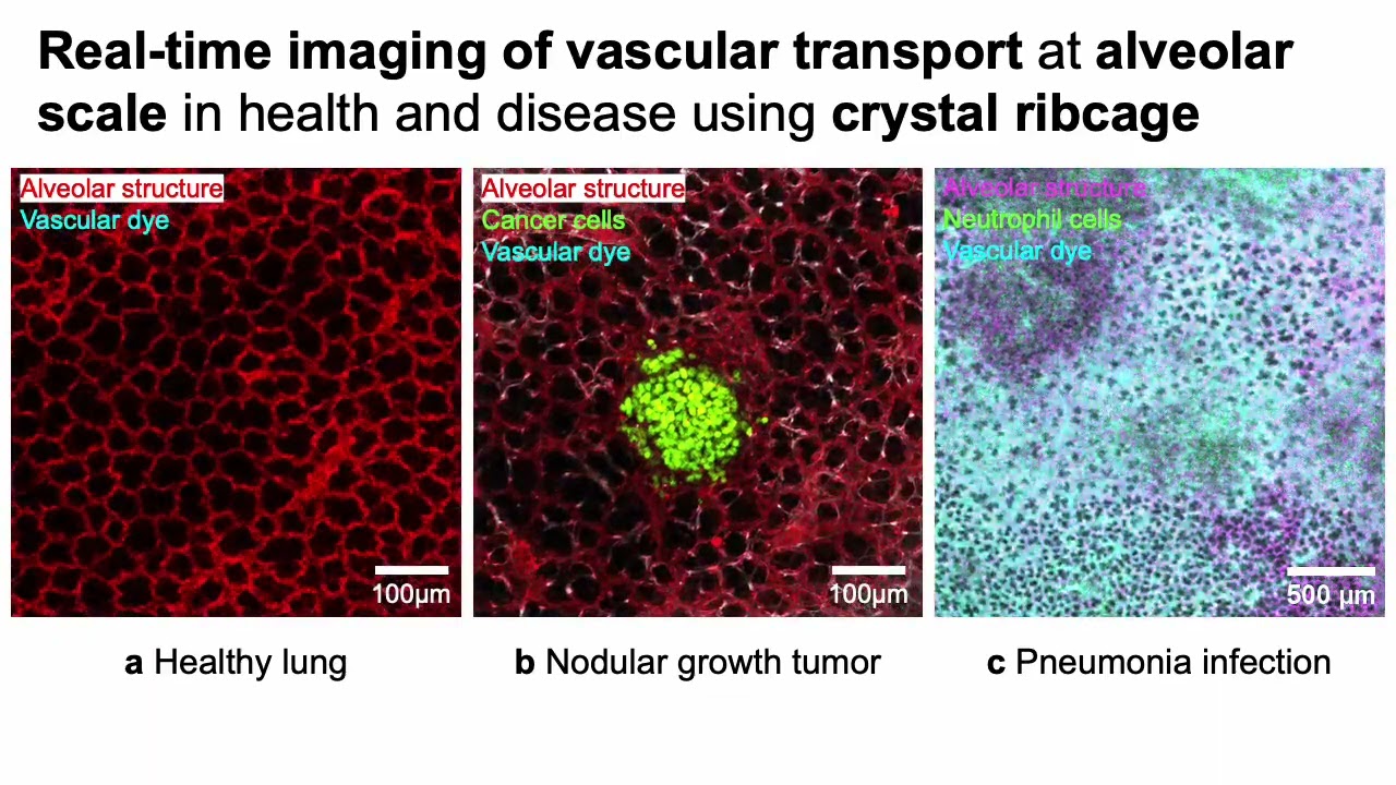 Real-time imaging of vascular flow in crystal ribcage
