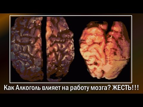 Как Алкоголь влияет на работу мозга? Жесть!!!