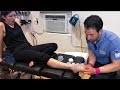 FOOT INJURY FROM CAR ACCIDENT! | Chiropractic Adjustment by Dr. Aaron