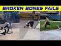 Broken bones fail  skateboarding fail edition 
