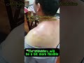Real Doctor Physical Therapy Case Study: Mr. You's Cervical Disc Herniation — First Treatment