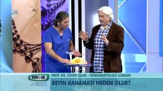 Beyin Kanaması Nasıl Olur?