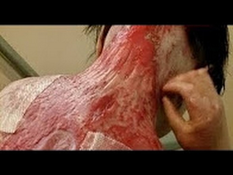 Жизнь без кожи Моя Ужасная История