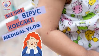 Жах для всіх батьків! Вірус Коксакі - все що про нього потрібно знати!