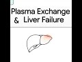 Plasma Exchange & Liver Failure