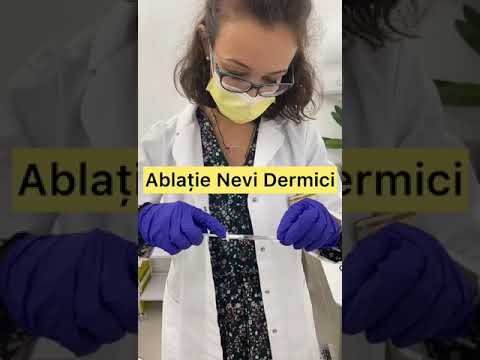 Video: Cine îndepărtează piercing-urile dermice?