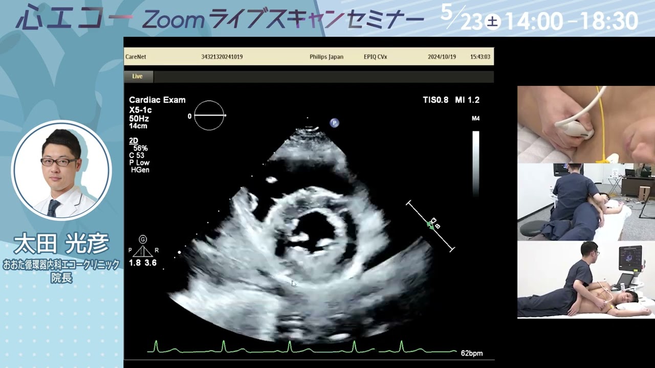 心エコー Zoomライブスキャンセミナー【S076】|CareNeTVスクール 心エコー Zoomライブスキャンセミナー【S076】|CareNeTVスクール