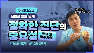 X-ray, MRI, CT의 차이점? [실제 환자 허리디스크 MRI]