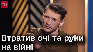 🦾 Андрій Смоленський про преспективи протезуватися і як орієнтується у просторі