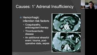 Endocrine Emergencies